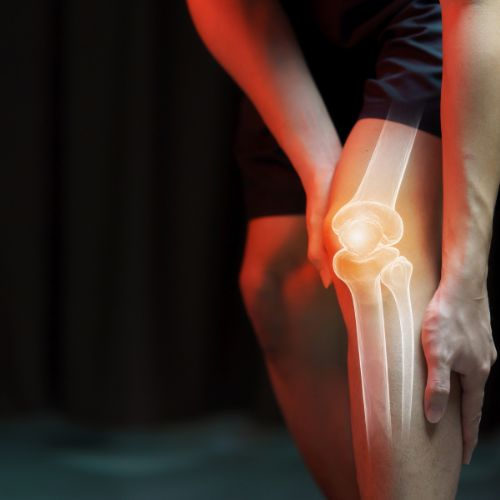 Personalized Joint Replacement Plans