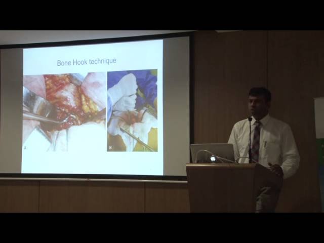 Complex primary Hip Replacement