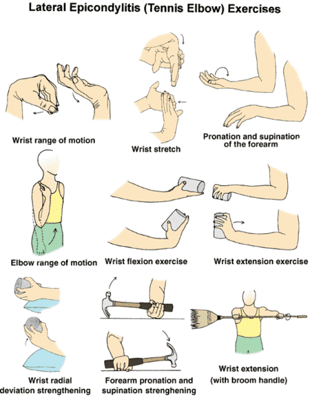 Tennis Elbow Rehabilitation Exercises